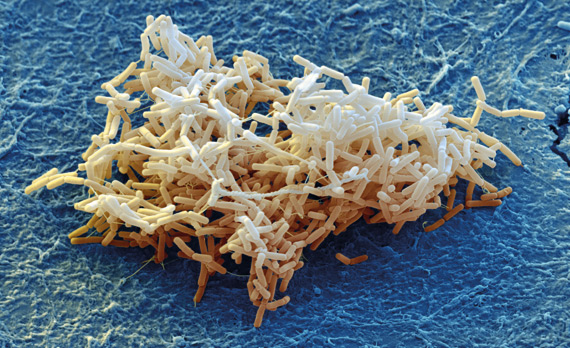 Biological versus chemical