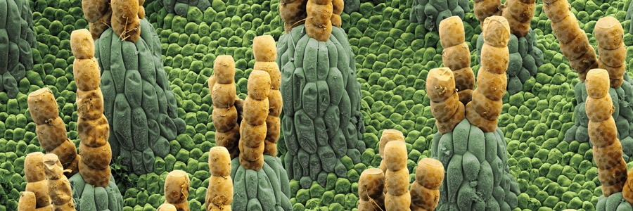 Interactions between nutrients